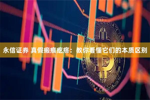 永信证券 真假瘢痕疙瘩：教你看懂它们的本质区别